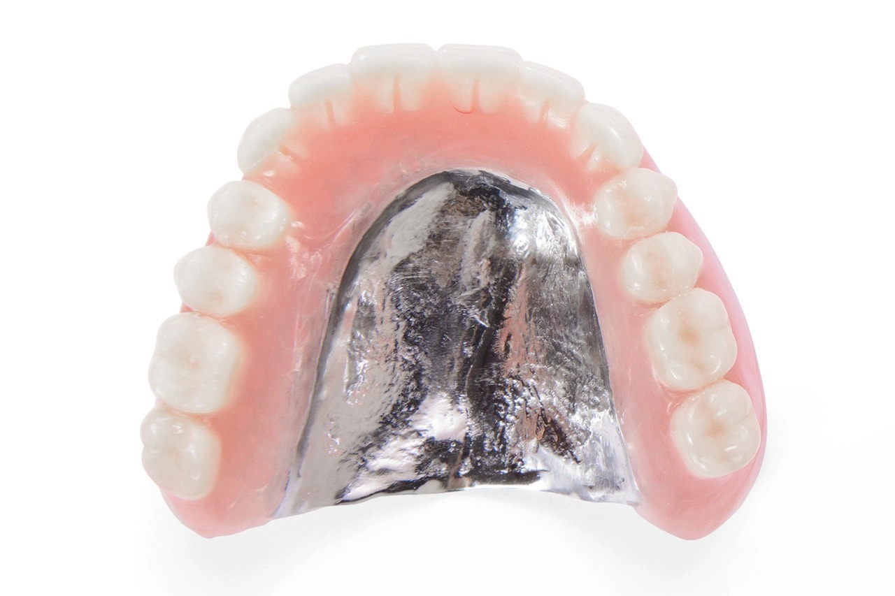 金属床義歯